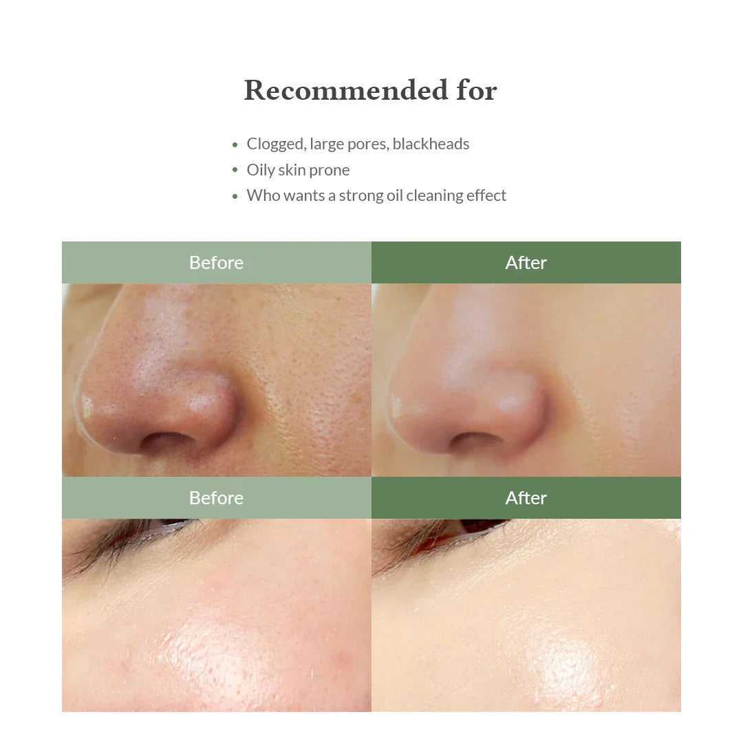 Dr Althea Premium Quick Step Sebum Cleanser-1